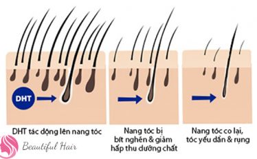 cach-phuc-hoi-nang-toc-yeu