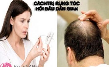 3-cach-chua-rung-toc-hoi-dau-dan-gian-don-gian-va-hieu-qua