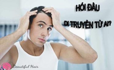 giai-dap-thac-mac-benh-hoi-dau-di-truyen-tu-ai