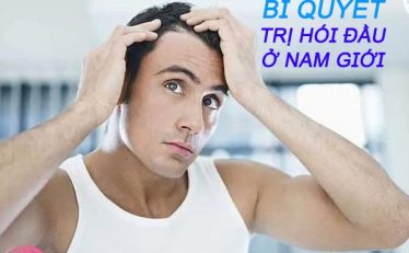 bi-quyet-don-gian-tri-hoi-dau-o-nam-gioi-ban-nen-biet