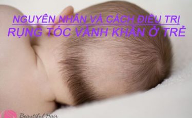 rung-toc-vanh-khan-o-tre-nguyen-nhan-va-cach-dieu-tri