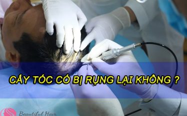 cay-toc-co-bi-rung-lai-khong