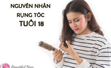 diem-nhanh-6-nguyen-nhan-rung-toc-o-tuoi-18