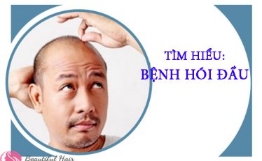 benh-hoi-dau-la-gi