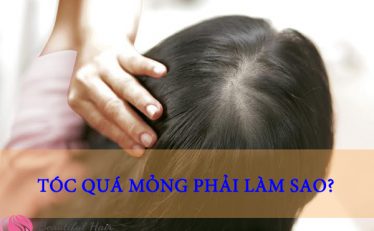 toc-qua-mong-phai-lam-sao-de-phuc-hoi