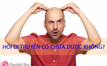 di-tim-giai-phap-tri-hoi-dau-di-truyen-dut-diem