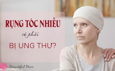 giai-dap-ban-khoan-rung-toc-co-phai-bi-ung-thu-khong