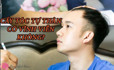 cay-toc-tu-than-co-vinh-vien-khong