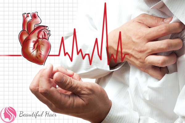 Vấn đề tim mạch không ổn định do thiếu máu