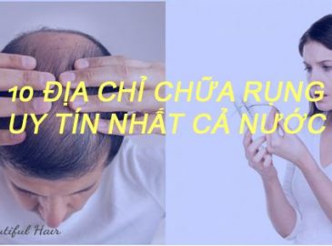 top-10-dia-chi-chua-rung-toc-uy-tin-nhat-ca-nuoc