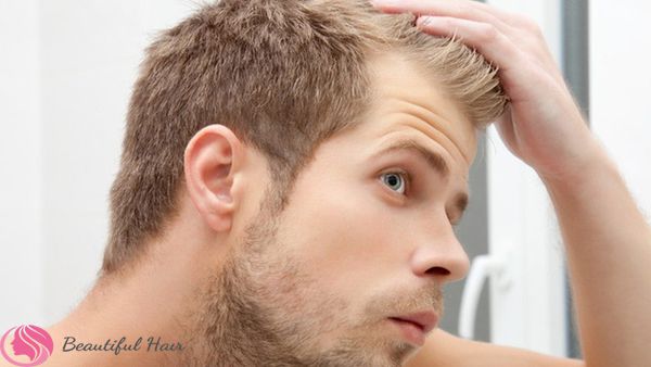 Vì sao đàn ông ngoài 30 tuổi rụng tóc nhiều