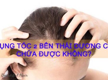 rung-toc-2-ben-thai-duong-co-chua-duoc-khong