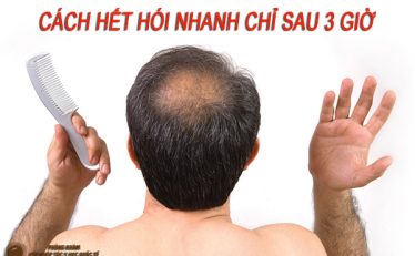 cach-het-hoi