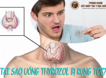 uong-thyrozol-bi-rung-toc