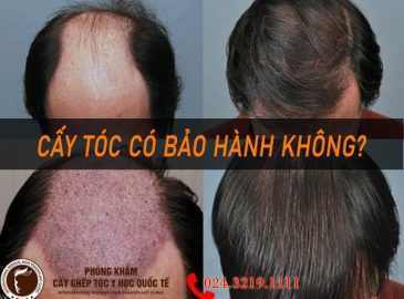 cay-toc-co-bao-hanh-khong