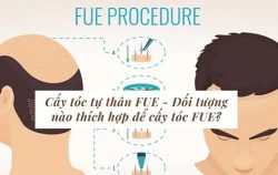 cay-toc-tu-than-fue-la-gi