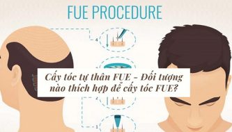 cay-toc-tu-than-fue-la-gi