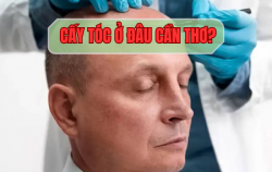 cay-toc-o-dau-can-tho-mach-ban-dia-chi-uy-tin-bac-si-gioi-cam-ket-hieu-qua