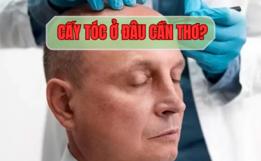 cay-toc-o-dau-can-tho-mach-ban-dia-chi-uy-tin-bac-si-gioi-cam-ket-hieu-qua