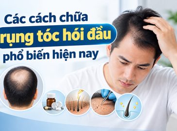 tim-hieu-cac-cach-chua-rung-toc-hoi-dau-pho-bien-hien-nay