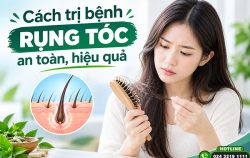 bo-tui-5-cach-tri-benh-rung-toc-an-toan-hieu-qua