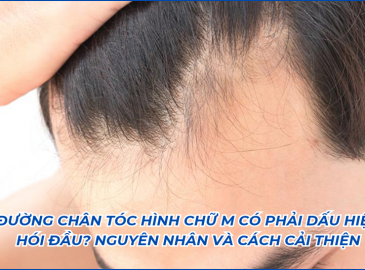 duong-chan-toc-hinh-chu-m-co-phai-dau-hieu-hoi-dau