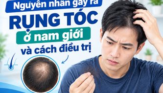 tim-hieu-nguyen-nhan-gay-ra-rung-toc-o-nam-gioi