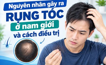 tim-hieu-nguyen-nhan-gay-ra-rung-toc-o-nam-gioi