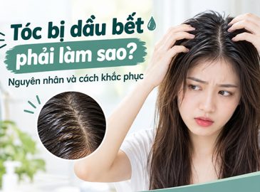 toc-bi-dau-bet-phai-lam-sao