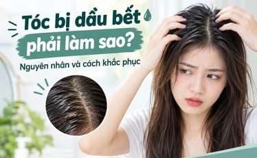toc-bi-dau-bet-phai-lam-sao