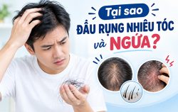 chuyen-gia-giai-dap-tai-sao-dau-rung-nhieu-toc-va-ngua