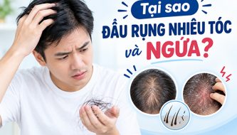 chuyen-gia-giai-dap-tai-sao-dau-rung-nhieu-toc-va-ngua