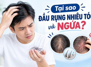 chuyen-gia-giai-dap-tai-sao-dau-rung-nhieu-toc-va-ngua