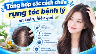 tong-hop-cac-cach-chua-rung-toc-benh-ly-an-toan-hieu-qua