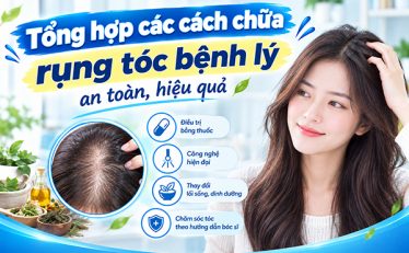 tong-hop-cac-cach-chua-rung-toc-benh-ly-an-toan-hieu-qua