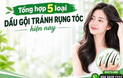 tong-hop-5-loai-dau-goi-tranh-rung-toc-duoc-chuyen-gia-khuyen-dung