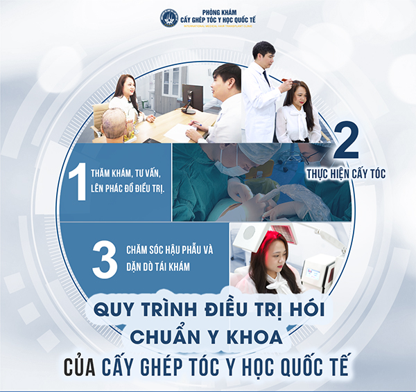 Điều trị rụng tóc chuyên sâu