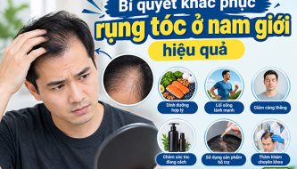 bi-quyet-khac-phuc-rung-toc-o-nam-gioi-hieu-qua