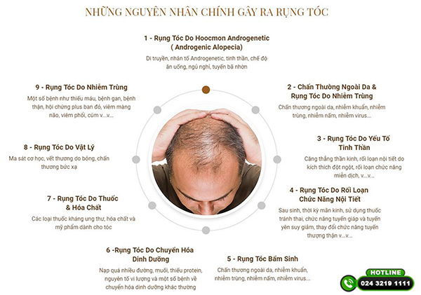 nguyên nhân rụng tóc ở nam