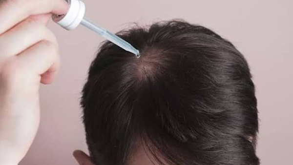 cách trị hói đầu