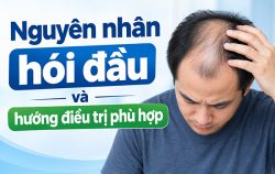 tim-hieu-nguyen-nhan-hoi-dau-va-huong-dieu-tri-phu-hop