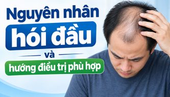 tim-hieu-nguyen-nhan-hoi-dau-va-huong-dieu-tri-phu-hop