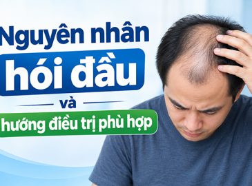 tim-hieu-nguyen-nhan-hoi-dau-va-huong-dieu-tri-phu-hop