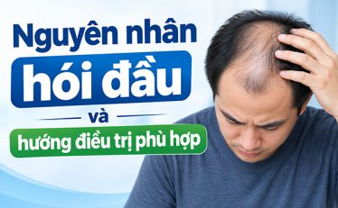 tim-hieu-nguyen-nhan-hoi-dau-va-huong-dieu-tri-phu-hop