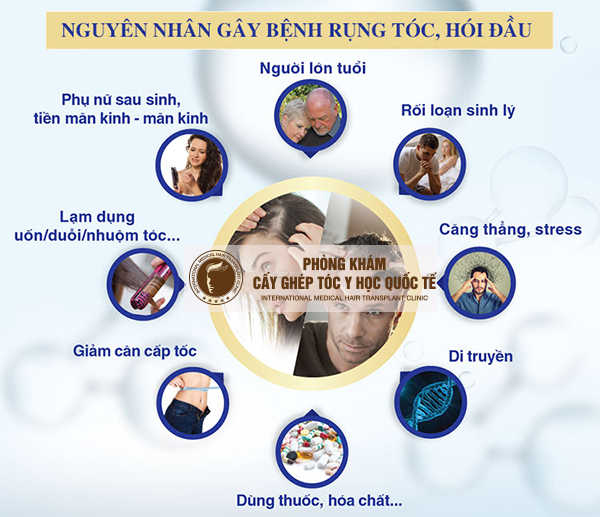 nguyên nhân rụng tóc hói đầu