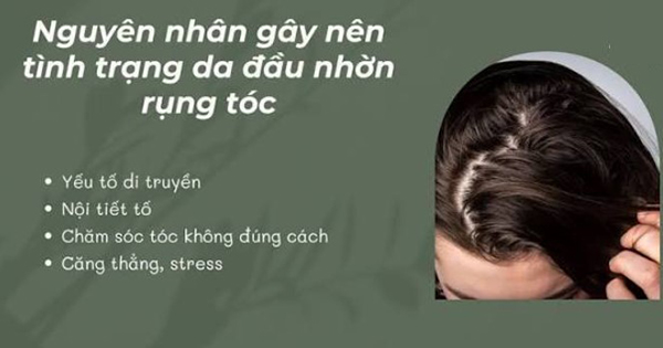 nguyên nhân tóc dầu
