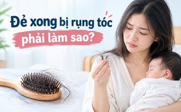 de-xong-bi-rung-toc-phai-lam-sao