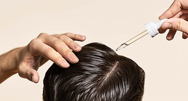 Điều trị rụng tóc ở nam giới hiệu quả, an toàn
