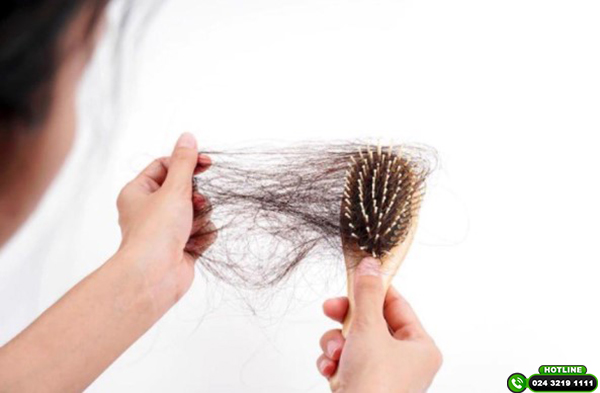 Top 7 sản phẩm thuốc uống chống rụng tóc hiệu quả hiện nay